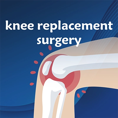 knee replacement surgery