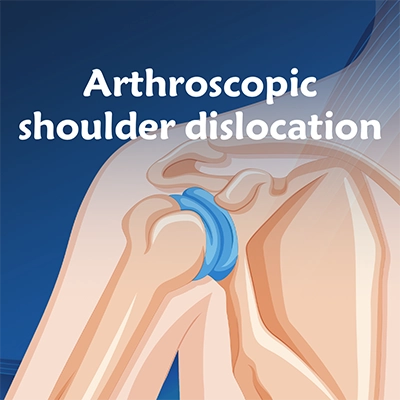 Arthroscopic shoulder dislocation