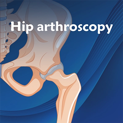 Hip arthroscopy